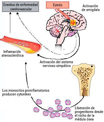Ilustración sobre el estrés