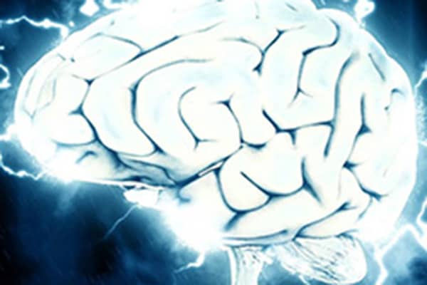 Cerebro