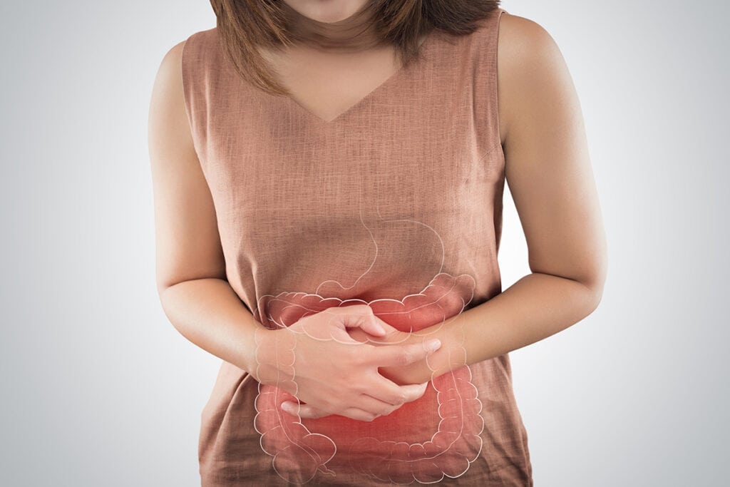 Una chica con una peristalsis alterada y movimientos peristálticos y motilidad baja.