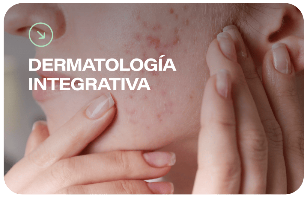 En la Clínica Regenera tratamos los problemas de la piel con un enfoque en dermatología integrativa